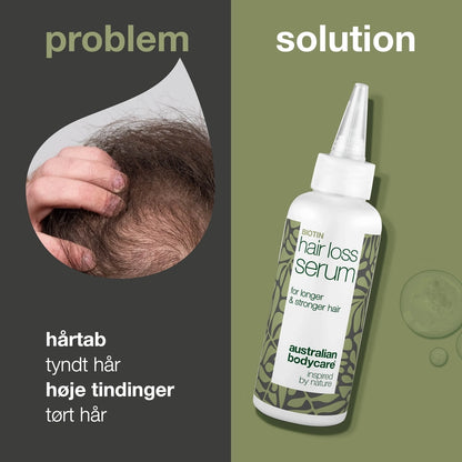  Australian Bodycare Hair Loss Serum 100 Ml