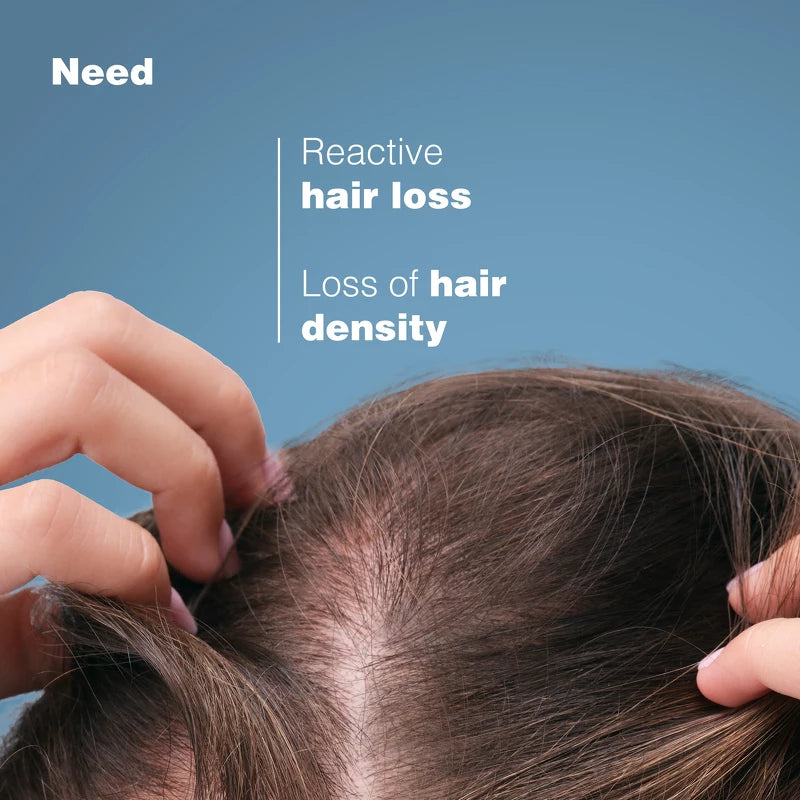  DUCRAY Anaphase Anti-Hair Loss And Growth Shampoo 200 Ml